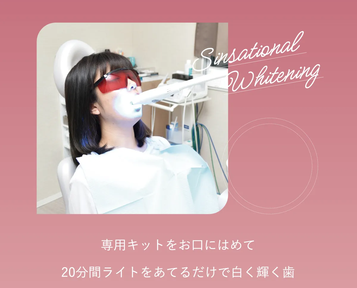 専用キットをお口にはめて20分間ライトをあてるだけで白く輝く歯