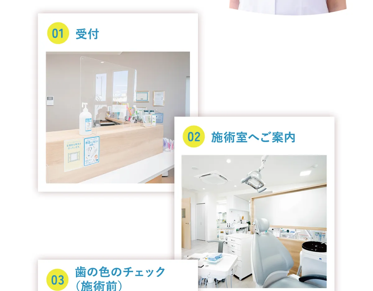1.受付 2.施術室へご案内 3.歯の色のチェック（施術前）