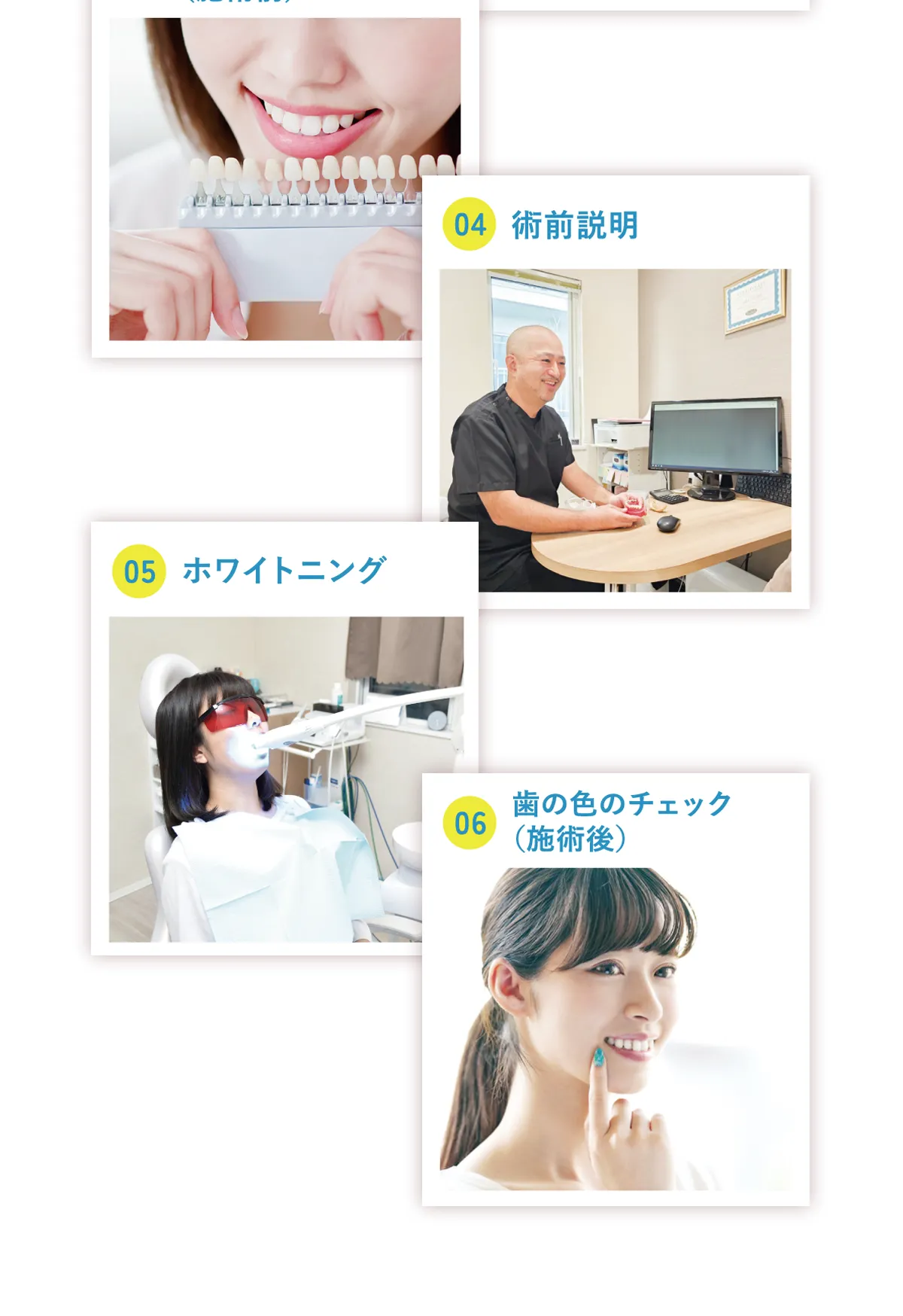 4.術前説明 5.ホワイトニング 6.歯の色のチェック（施術後）